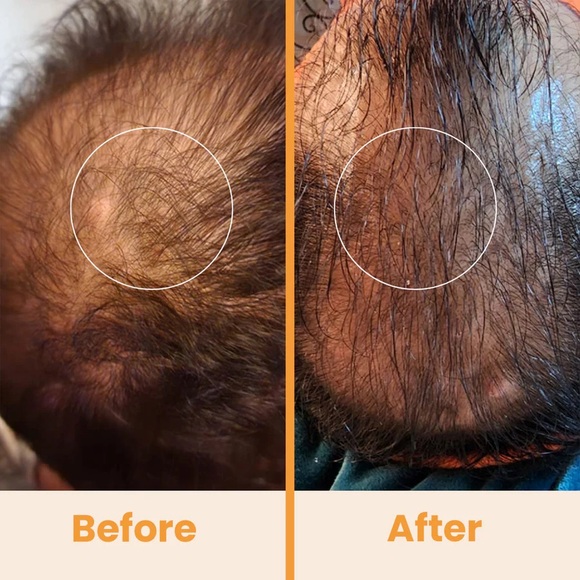 NuDerma Natural Dermal Cell Energy Amplification System - White - Picture 8 of 10